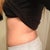 Side view before pic