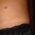 rrrrrrr.I hate that scar..