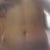 my right is thinner tahn left.is it normal?
