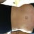 4 weeks post op!