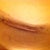 left incision. Do you think the stitch is dissolve-able?