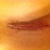 right incision is a little more tender. The white spots are dead flaky skin sorry