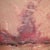 Close up of bruise- looks painful but I don't feel it. Dr. says it will take a few weeks to heal, but not a big deal (pray he's right)