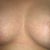 8-dpo (lefty looks bigger than righty!) hoping it is the angle or one hasn't dropped! Definitely don't want 2 different size boobies!