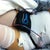 This is me immediately after surgery -- within an hour or two