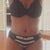 1 month post op