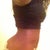 When i first took garment off this evening less swelling if u can tell lol