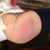 My sides from the lipo.  I didn't think that my bruising was  bad at all .  Day 3 po