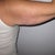 Pre-op right batwing back view