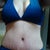 6.5weeks PO: First bikini in 22 years