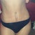7 wks post op