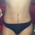 7 weeks post op