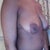 SIDE VIEW OF ME NOW