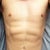 10 weeks post Vaser Lipo.