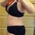 5 weeks post-op (still swollen)