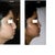 before after profile