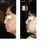 before after profile