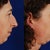 Dr's before and after simluation
