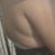 Horrible fat hanging from my upper back 4 weeks 3 days after bbl :-/