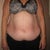 I cannot believe I am posting these pics!!  
pre-op front view