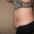 pre-op left side