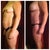 Before and 4 weeks post op.