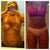Before and 7 months post op