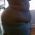 day 6 looks like before pic im swollen and sore