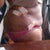 this is day 2 of my surgery i do see a slight difference