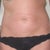 June 2010 - 7 months on - can you spot the scars??