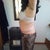 7 days post op side