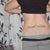 2 wks, swollen all the way around. See my flat bum, got that fixed later...