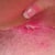Looks infected
