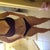 Body Shot at 2 weeks post op