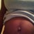 Before pic