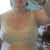 After 3 -- 1 week post op