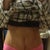 Very happy that my underwear will cover scar naturally as well :) also i can finally see some thigh gap! never had that before , however doctor says that i will see the  final results in about 4-6 months on lipo.