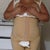 Front view of my sister that had lipo n butt fat transfer