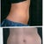 Before from side and front