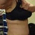 3 months after tummy tuck