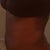 Day 6 post side. I had to take this pic myself, so I am turned to the side a bit