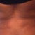 Day 6 post back.