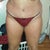 10 DAYS POST OP