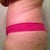 Left side 7 weeks
