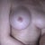 right breast getting harder