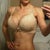 5 months post op