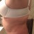 Before side view