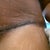 close up of right side of my incision. 4 day post op