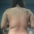 Back view ( before brazilian butt lift  )