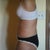 16 days Post OP